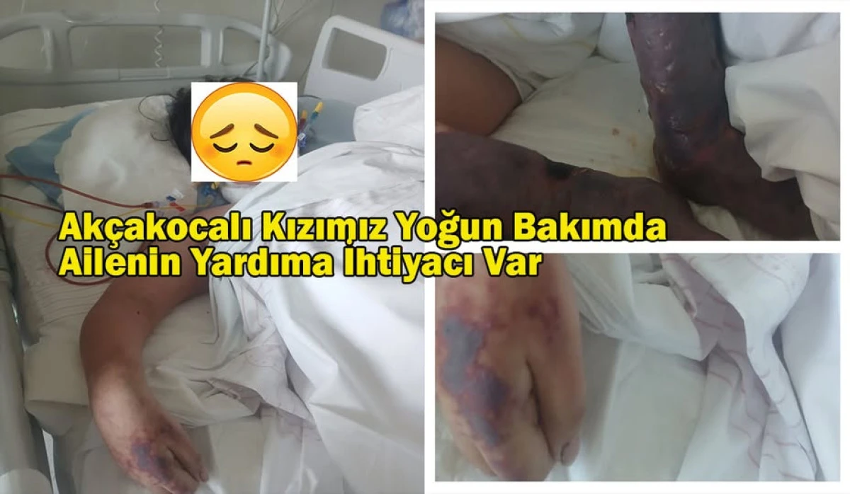 Ak&ccedil;akocalı Hilal Akdeniz İ&ccedil;in Yardım &Ccedil;ağrısı